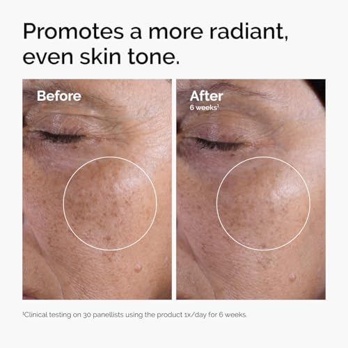 The Ordinary Glycolic Acid 7% Exfoliating Toner – Brightening & Smoothing Skincare